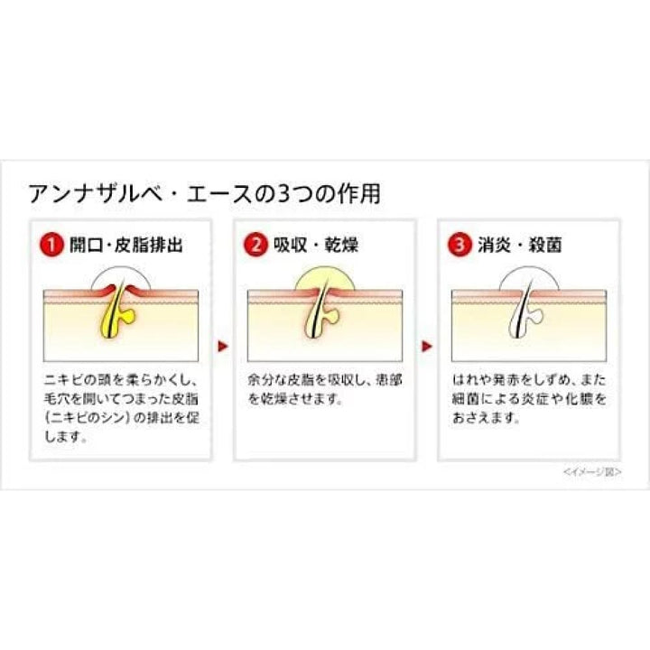 Annasalbe Ace Cream 18g, Acne & Oil Control, For Acne, 白兔牌