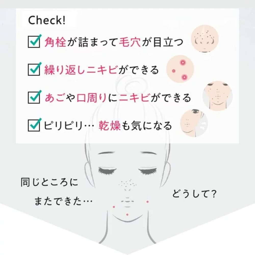 FANCL Acne Care Milky Gel 18g, $90以上, Acne & Oil Control, fancl, For Acne