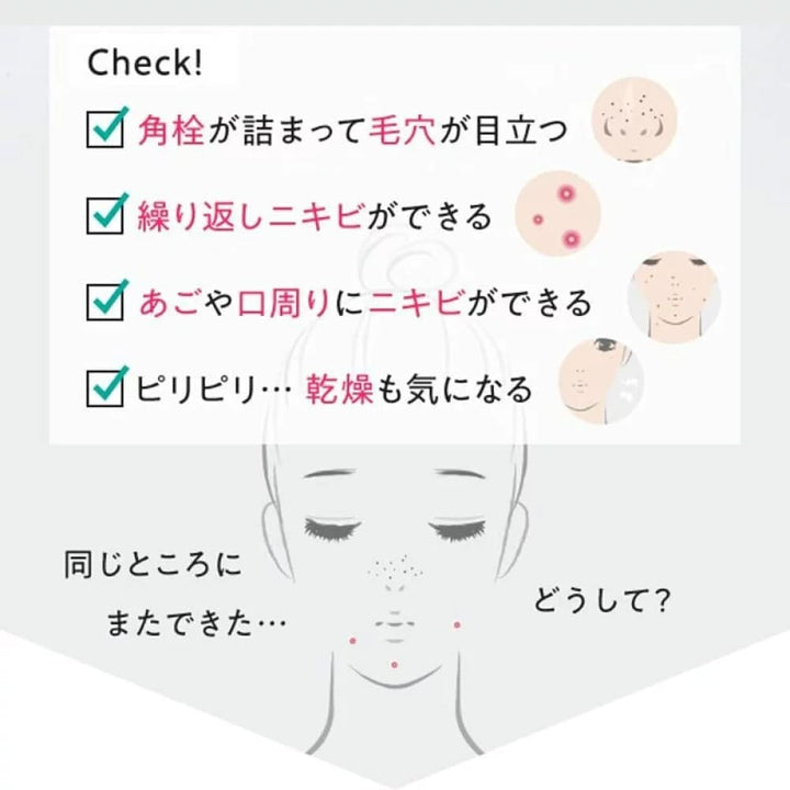 FANCL Acne Care Milky Gel 18g, $90以上, Acne & Oil Control, fancl, For Acne