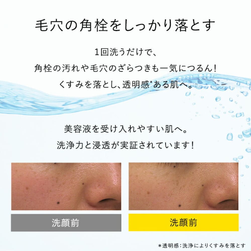 SKIO VC Boost Gel Wash 140g